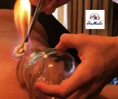 Chinese Fire Cupping Therapy (Level 2) 21 April 2024 at AcuMedic Centre