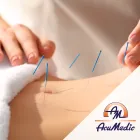Advanced Acupuncture – Fertility (Level 5)  5-6 Sept. 2024 at AcuMedic Centre
